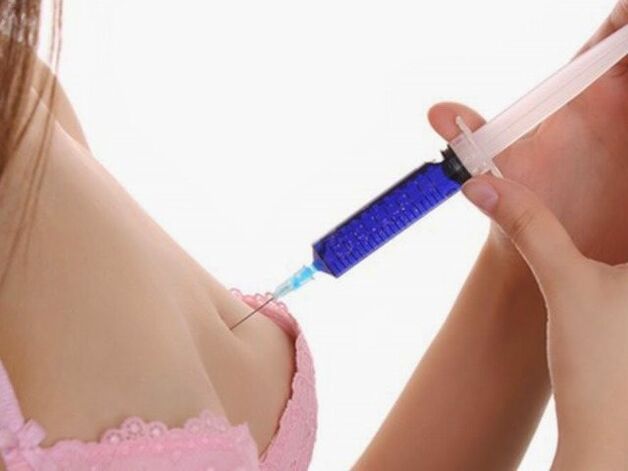 injections of hyaluronic acid for breast augmentation
