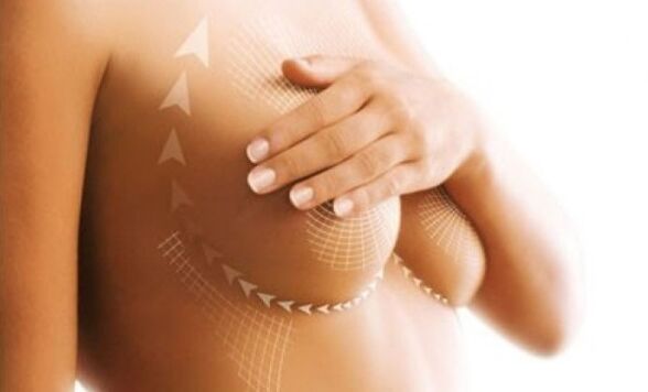 lifting the suture for breast augmentation