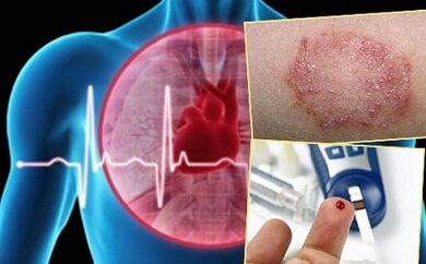 Contraindications for LippoliFting