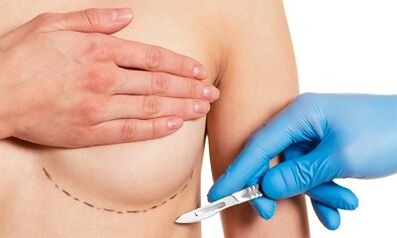 Underwater access to breast enlargement with the plants