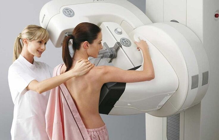 Mammography before breast augmentation surgery