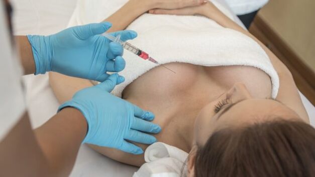 Breast augmentation procedure with hyaluronic acid