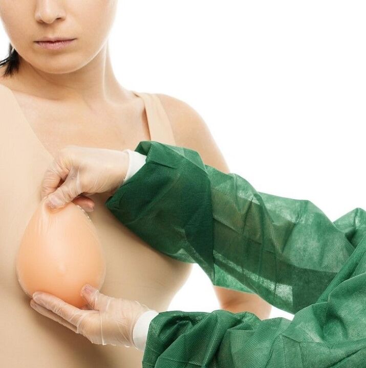 breast enlargement prosthesis